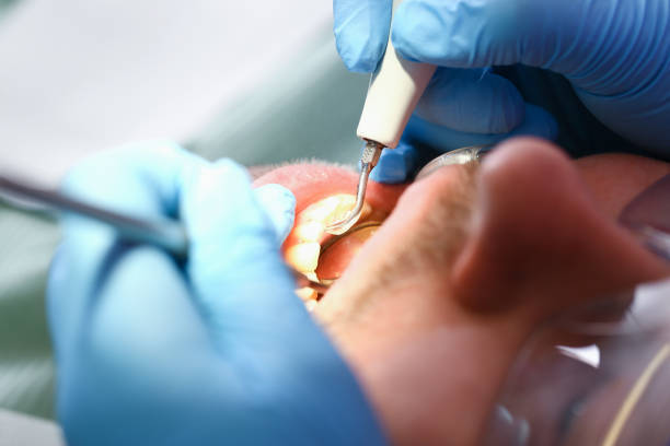 Best Emergency Care for Gum Disease in Duncanville, TX